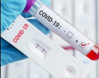 842 са новите случаи на коронавирус у нас за изминалото денонощие Направени